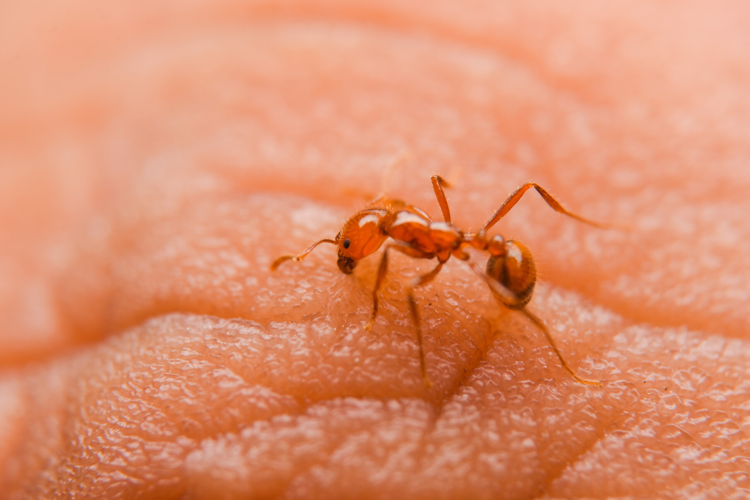 red ant bite finger Alergia a picada de formifa